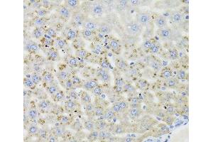 Immunohistochemistry of paraffin-embedded Mouse liver using HSD17B13 Polyclonal Antibody at dilution of 1:100 (40x lens). (HSD17B13 抗体)