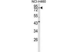 Western blot analysis of Spartin (arrow) in NCI-H460 cell line lysates (35ug/lane) using Spartin / SPG20  Antibody  (N-term). (SPG20 抗体  (N-Term))