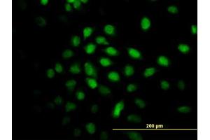 Image no. 3 for anti-Calcium Responsive Transcription Factor (CARF) (AA 621-719) antibody (ABIN599306) (Calcium Responsive Transcription Factor (CARF) (AA 621-719) 抗体)