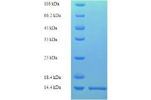 SDS-PAGE (SDS) image for Histone H2B Type 2-E (HIST2H2BE) (AA 2-93) protein (His tag) (ABIN5710982)