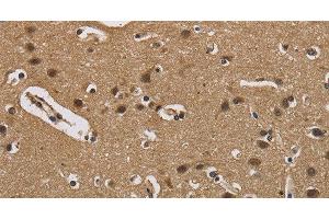 Immunohistochemistry of paraffin-embedded Human brain using FABP2 Polyclonal Antibody at dilution of 1:40 (FABP2 抗体)