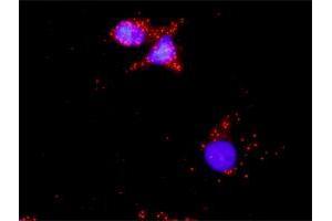 Proximity Ligation Analysis of protein-protein interactions between TP53 and LAMA4. (LAMa4 抗体  (AA 1-120))