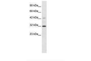 Image no. 2 for anti-Voltage-Dependent Anion Channel 1 (VDAC1) (C-Term) antibody (ABIN202157) (VDAC1 抗体  (C-Term))