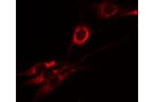 ABIN6274970 staining A549 by IF/ICC. (CPM 抗体  (Internal Region))