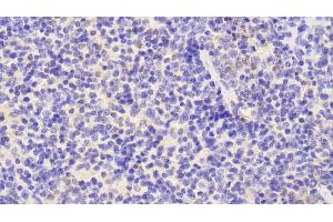 Immunohistochemistry (IHC) image for anti-CD177 Molecule (CD177) (AA 193-468) antibody (ABIN7440029)