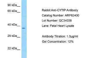 Western Blotting (WB) image for anti-Cytohesin 1 Interacting Protein (CYTIP) (N-Term) antibody (ABIN970496) (CYTIP 抗体  (N-Term))