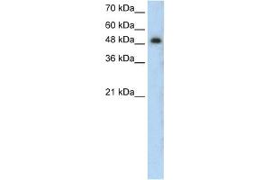 WB Suggested Anti-PRKCZ Antibody Titration:  0. (PKC zeta 抗体  (N-Term))