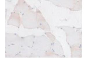 Detection of BCKDK in Rat Skeletal Muscle Tissue using Polyclonal Antibody to Branched Chain Alpha-Ketoacid Dehydrogenase Kinase (BCKDK) (BCKDK 抗体  (AA 44-223))