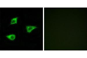 Peptide - +Immunofluorescence analysis of LOVO cells, using CHRM4 antibody. (CHRM4 抗体  (Internal Region))