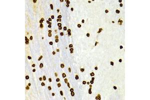 Immunohistochemistry of paraffin-embedded Rat brain using H3K27me2 antibody at dilution of 1:100 (x400 lens). (Histone 3 抗体  (H3K27me))