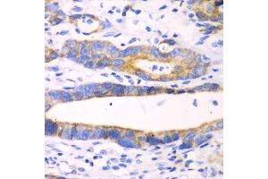 Immunohistochemistry (Paraffin-embedded Sections) (IHC (p)) image for anti-Chitinase, Acidic (CHIA) (AA 1-368) antibody (ABIN1679217)