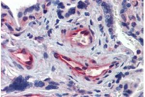 Human Placenta: Formalin-Fixed, Paraffin-Embedded (FFPE) (Akirin 1 抗体  (N-Term))