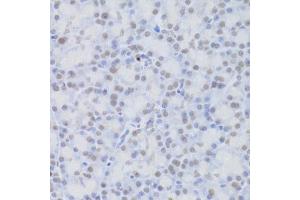 Immunohistochemistry of paraffin-embedded rat pancreas using JMJD6 Antibody (ABIN5973452) at dilution of 1/100 (40x lens). (JMJD6 抗体)