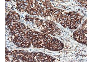 Image no. 9 for anti-Ubiquitin Specific Peptidase 9, X-Linked (USP9X) (AA 2246-2570) antibody (ABIN1491228)