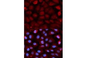 Immunofluorescence analysis of U2OS cells using FMR1 antibody. (FMR1 抗体)
