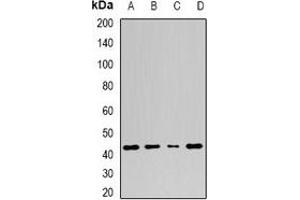 Western blot analysis of Adenosine Deaminase expression in A549 (A), Jurkat (B), mouse spleen (C), mouse stomach (D) whole cell lysates. (ADA 抗体)