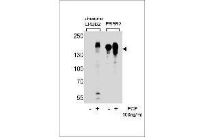 Western blot analysis of extracts from A431 cells,untreated or treated with EGF,100 ng/mL,using phospho ErbB2-(left) or ErbB2 Antibody (right) (ErbB2/Her2 抗体  (pTyr1221))