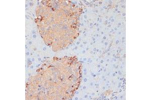 Immunohistochemistry (IHC) image for anti-Protein tyrosine Phosphatase, Receptor Type, N Polypeptide 2 (PTPRN2) (AA 22-242) antibody (ABIN7269710)