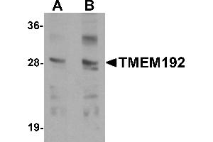 Western blot analysis of TMEM192 in SK-N-SH cell lysate with TMEM192 antibody at (A) 0. (TMEM192 抗体  (C-Term))