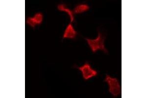 ABIN6269199 staining MCF7 by IF/ICC. (NFKBIA 抗体  (C-Term))