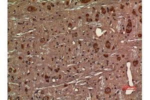 Immunohistochemistry (IHC) analysis of paraffin-embedded Rat Brain, antibody was diluted at 1:100. (CX3CR1 抗体  (Internal Region))