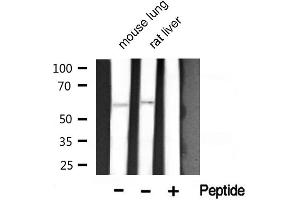 Western blot analysis of Akt1 phosphorylation expression in mouse lung and rat liver lysates,The lane on the right is treated with the antigen-specific peptide. (AKT1 抗体  (pThr450))