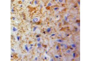 IHC-P analysis of Brain tissue, with DAB staining. (Neuroglobin 抗体  (AA 1-151))