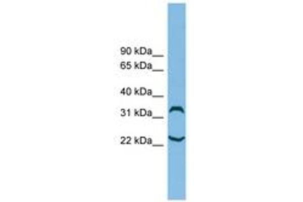 Chromosome 6 Open Reading Frame 134 (C6orf134) (N-Term) 抗体