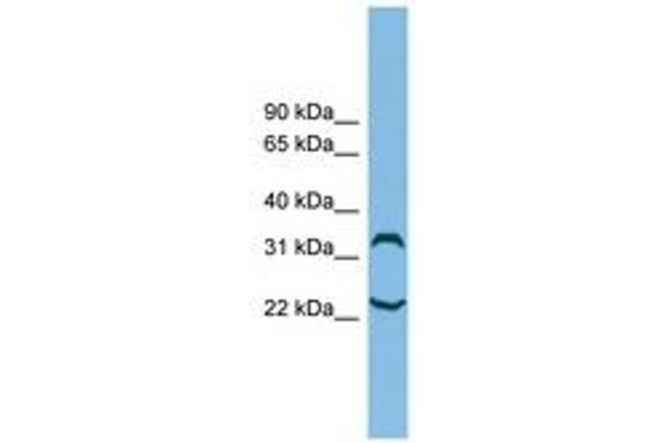 Chromosome 6 Open Reading Frame 134 (C6orf134) (N-Term) anticorps