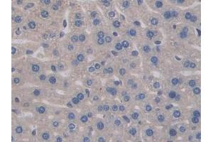 Immunohistochemistry (IHC) image for anti-Interleukin 17 Receptor A (IL17RA) (AA 590-848) antibody (ABIN7438775)