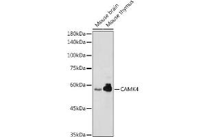 Western blot analysis of extracts of various cell lines, using C antibody (ABIN6130035, ABIN6137891, ABIN6137892 and ABIN6220925) at 1:1000 dilution. (CAMK4 抗体  (AA 304-473))