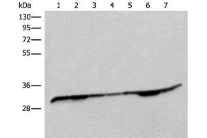 Western blot analysis of Rat heart tissue Mouse heart tissue Rat brain tissue Mouse brain tissue HEPG2 cell Jurkat and Lovo cell lysates using RSU1 Polyclonal Antibody at dilution of 1:400 (RSU1 抗体)