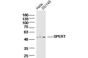 Lane 1: HeLa, Lane 2: DU145 cell lysates probed with SPERT Polyclonal Antibody  at 1:300 overnight at 4°C followed by a conjugated secondary antibody for 60 minutes at 37°C. (SPERT 抗体  (AA 1-100))
