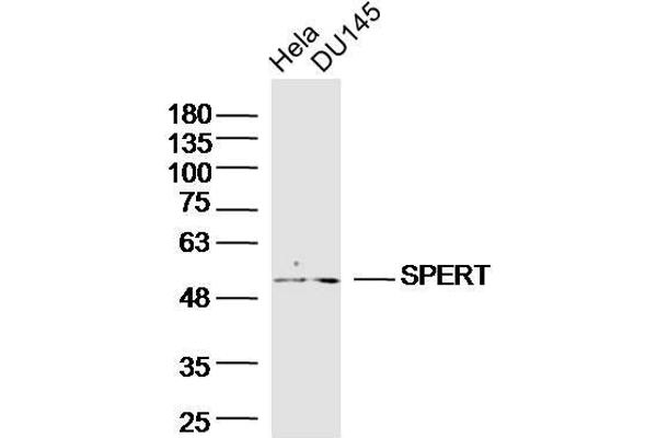 SPERT 抗体  (AA 1-100)