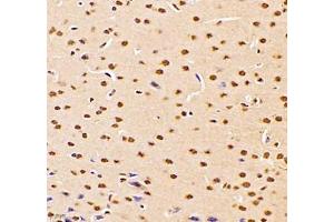 Immunohistochemistry of paraffin embedded mouse brain using DMRTA2 (ABIN7073753) at dilution of 1: 700 (400x lens) (DMRTA2 抗体)