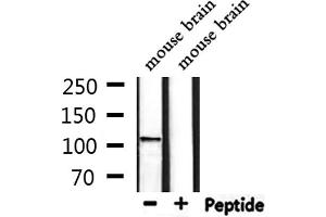 Western blot analysis of extracts from mouse brain, using CACNA2D4 Antibody. (CACNA2D4 抗体  (Internal Region))