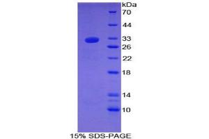 SDS-PAGE analysis of Rat Laminin gamma 1 Protein. (Laminin gamma 1 蛋白)