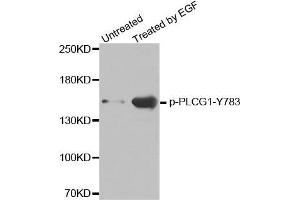 Western blot analysis of extracts from HL60 cells, using phospho-PLCG1-Y783 antibody. (Phospholipase C gamma 1 抗体  (pTyr783))