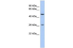 WB Suggested Anti-LBX1 Antibody Titration: 0. (Lbx1 抗体  (Middle Region))