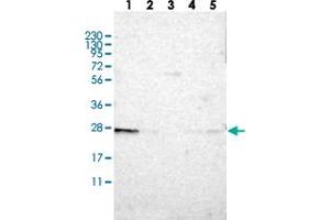 Western blot analysis of Lane 1: RT-4, Lane 2: U-251 MG, Lane 3: Human Plasma, Lane 4: Liver, Lane 5: Tonsil with TMED9 polyclonal antibody .