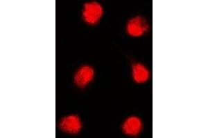Immunofluorescent analysis of APTX staining in K562 cells. (Aprataxin 抗体)
