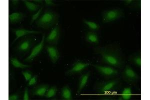 Immunofluorescence of monoclonal antibody to MAPKAPK2 on HeLa cell. (MAPKAP Kinase 2 抗体  (AA 302-400))