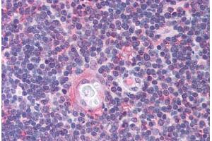Human Thymus (formalin-fixed, paraffin-embedded) stained with CDC25B antibody ABIN214736 at 5 ug/ml followed by biotinylated goat anti-rabbit IgG secondary antibody ABIN481713, alkaline phosphatase-streptavidin and chromogen. (CDC25B 抗体  (AA 56-105))