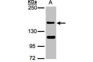 WB Image Sample(30 ug whole cell lysate) A:Raji , 5% SDS PAGE antibody diluted at 1:1000 (WHSC1 抗体  (N-Term))