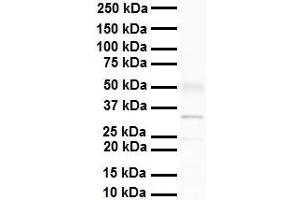 WB Suggested Anti-Pantibody Titration: 1 ug/mL Sample Type: Human heart (PARP16 抗体  (N-Term))