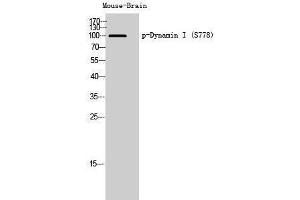 Western Blotting (WB) image for anti-Dynamin 1 (DNM1) (pSer778) antibody (ABIN3182341) (Dynamin 1 抗体  (pSer778))