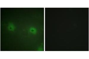 Immunofluorescence (IF) image for anti-Signal Transducing Adaptor Molecule (SH3 Domain and ITAM Motif) 2 (STAM2) (AA 161-210) antibody (ABIN2888934) (STAM2 抗体  (AA 161-210))