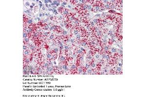 Immunohistochemistry with Human Liver cell lysate tissue at an antibody concentration of 5. (SP4 抗体  (Middle Region))