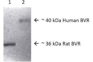Western blot analysis of Human, Rat Brain cell lysates showing detection of BVR protein using Rabbit Anti-BVR Polyclonal Antibody . (Biliverdin Reductase 抗体  (Biotin))