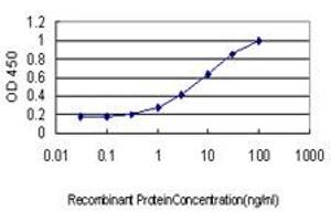 Detection limit for recombinant GST tagged STK17B is approximately 0. (DRAK2 抗体  (AA 272-372))